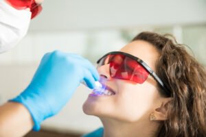 Affordable teeth whitening services in Edmonton